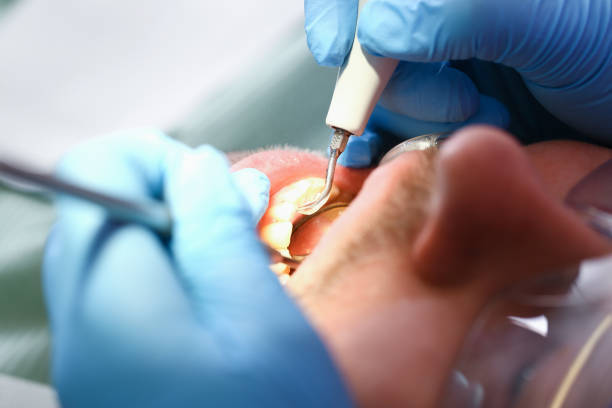 Best Pediatric Emergency Dentist in Redfield, SD